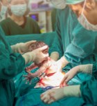 ניתוח קיסרי - תמונת המחשה